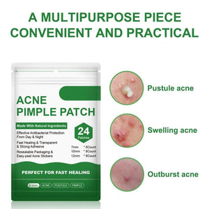 Acne Pimple Patch/Sticker 24Pcs